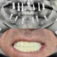 UMay Dent Ağız Diş Sağlığı Polikliniği